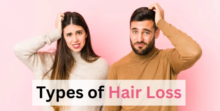 Types of Hair Loss