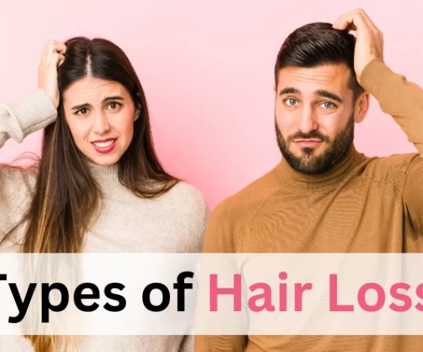 Types of Hair Loss: Understanding the Causes and Finding the Best Treatments