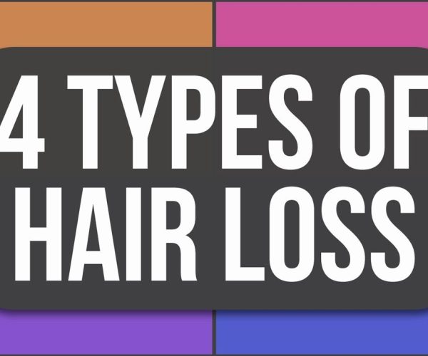 Understanding Types of Hair Loss: Insights from a Dermatologist